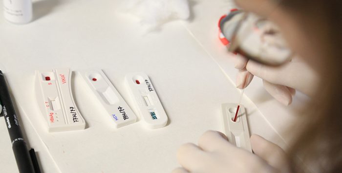 Com alta nos casos de hepatites, Sesau alerta para necessidade de vacinação