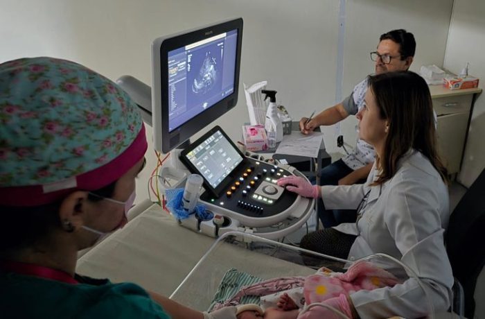 Novo ecocardiograma garante diagnósticos mais precisos, inclusive para prematuros, no HRMS